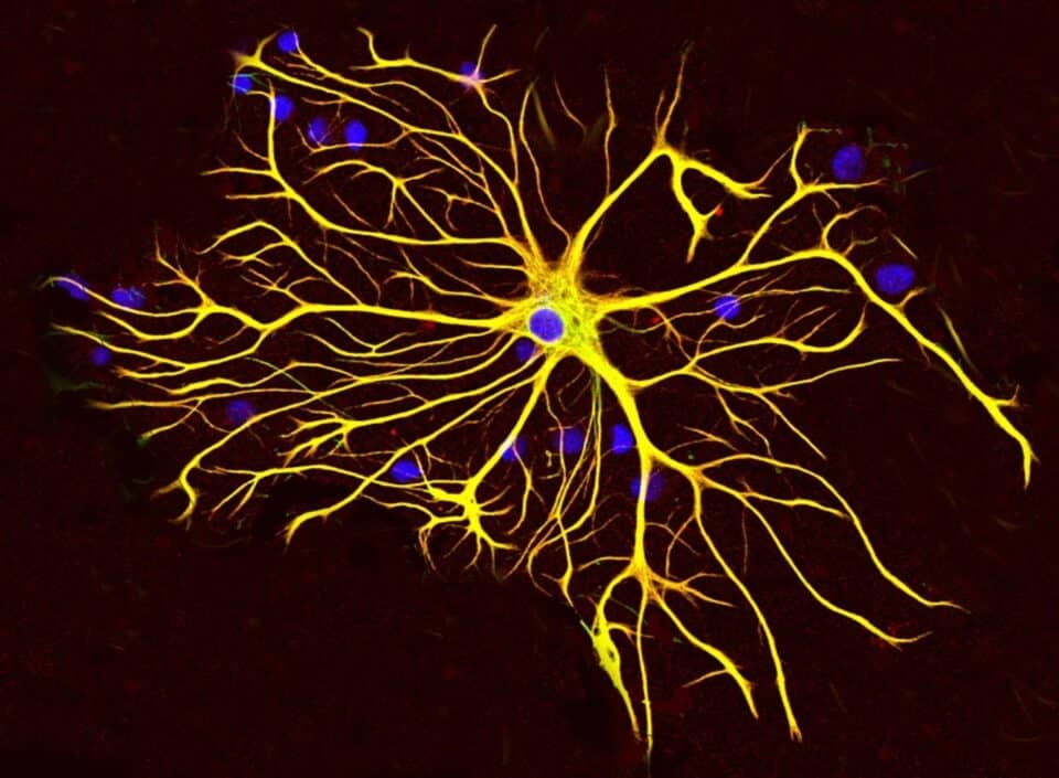 Células da Glia, o que é? tipos, classificações e características